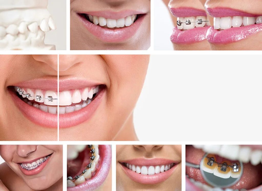 Orthodontics