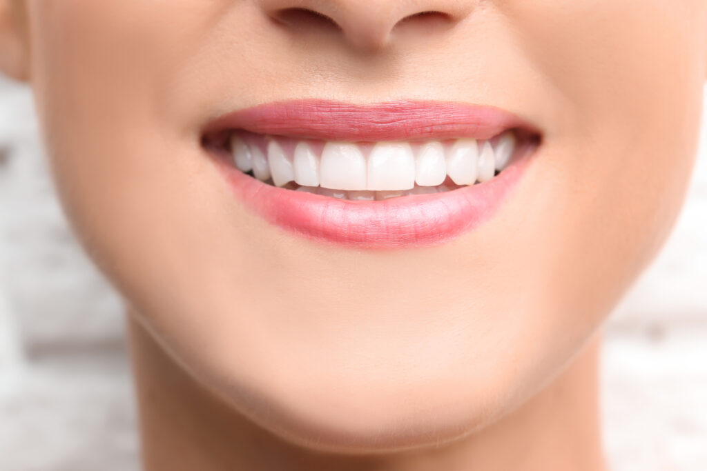 Close up of a woman's teeth 