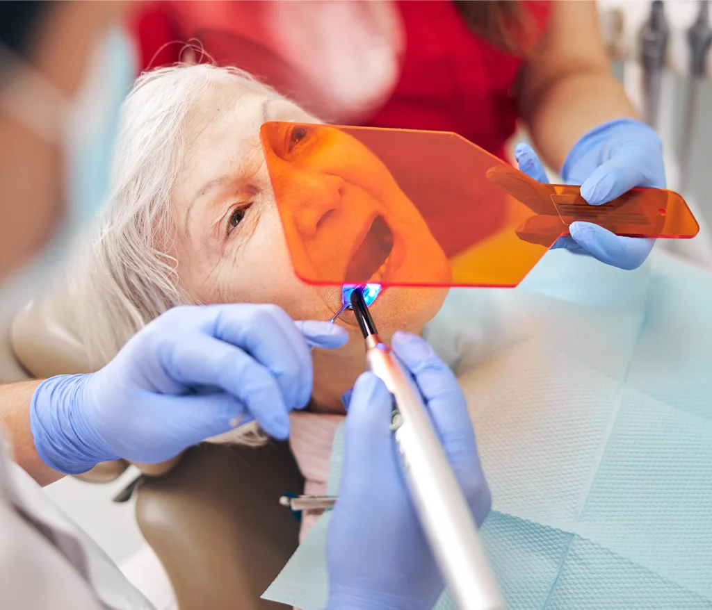 composite bonding