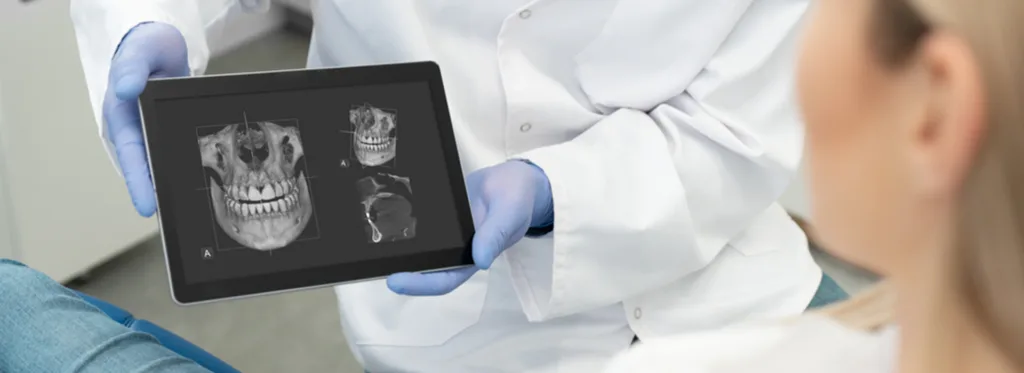 dental xray