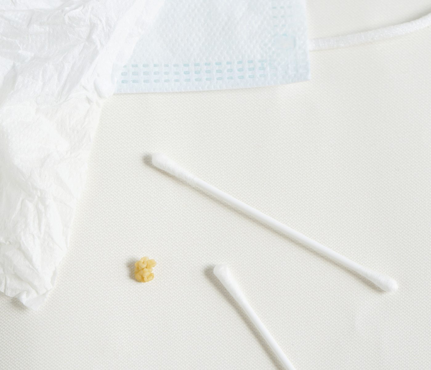 Tonsil stone and cotton swabs