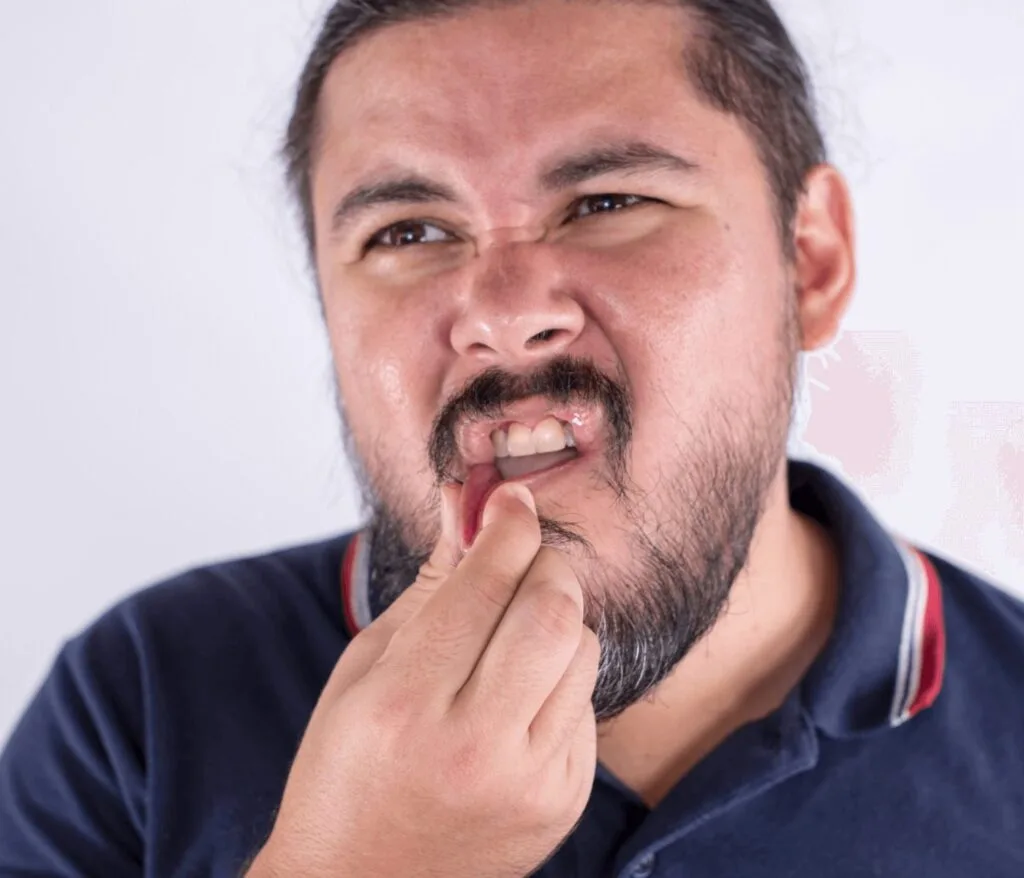 Numb Mouth