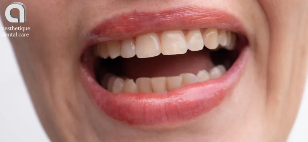 bitter taste in mouth - photo of a mouth open - blog cover